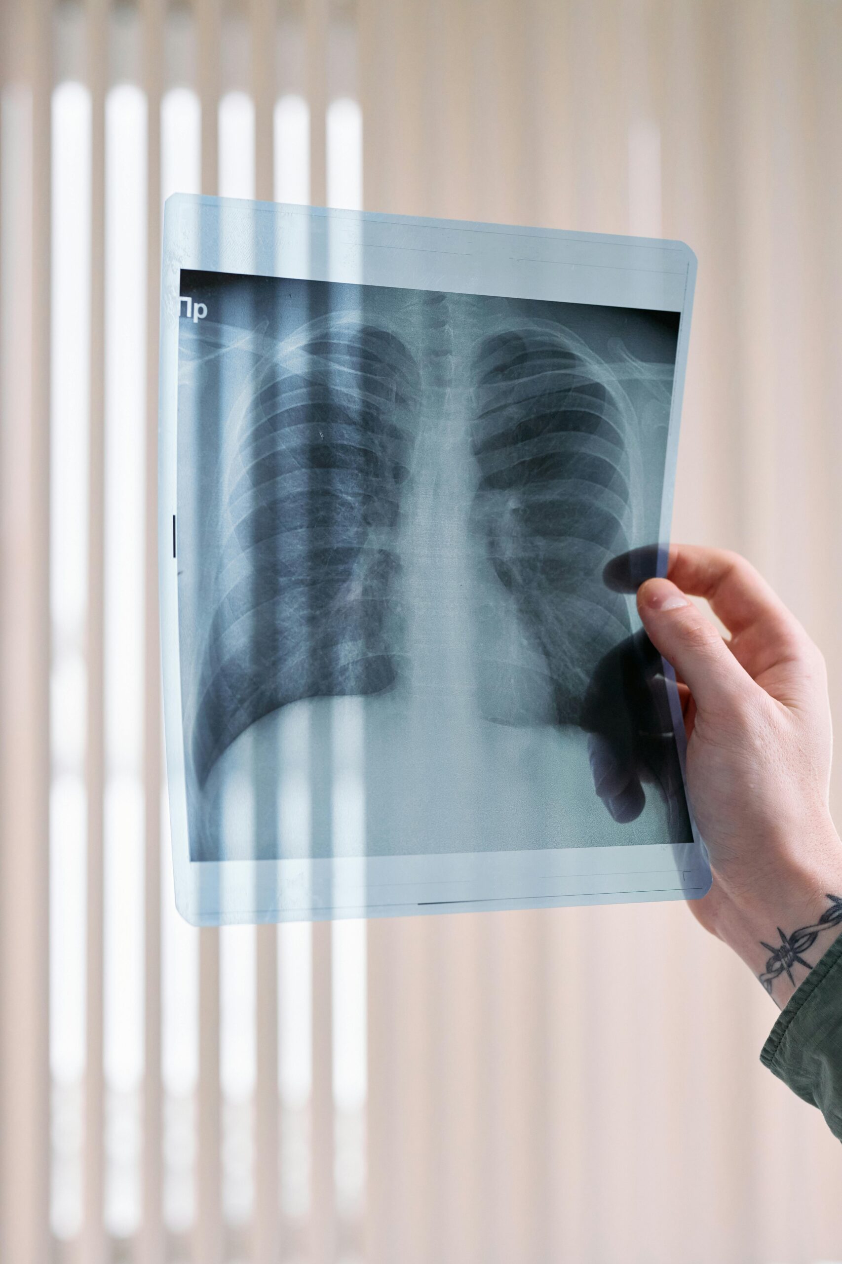 Rare Lung Condition